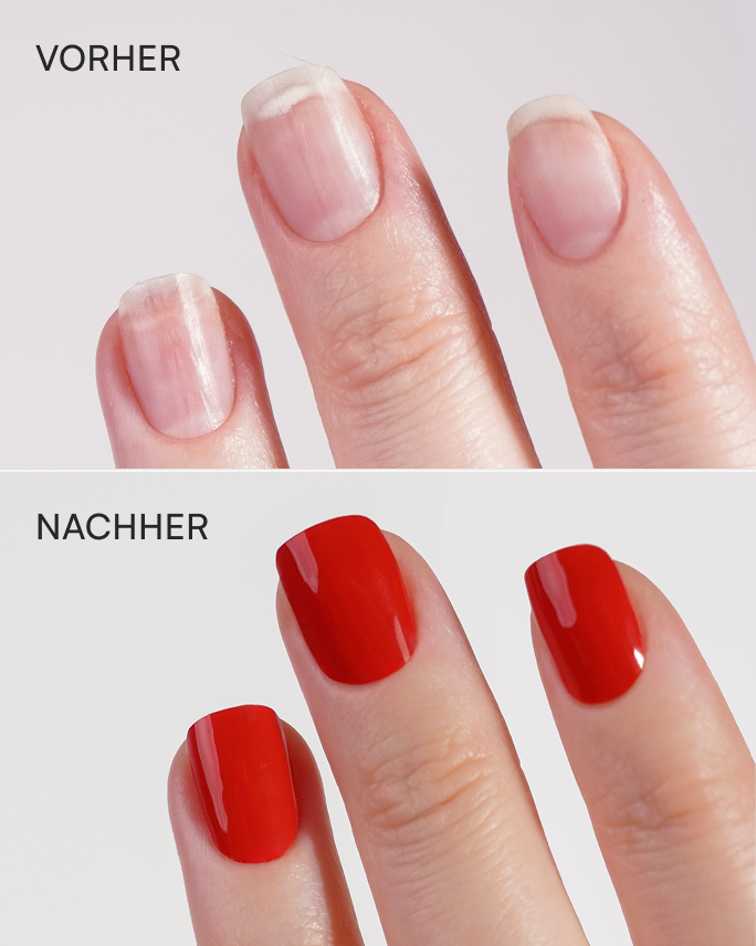 Vorher und Nachher